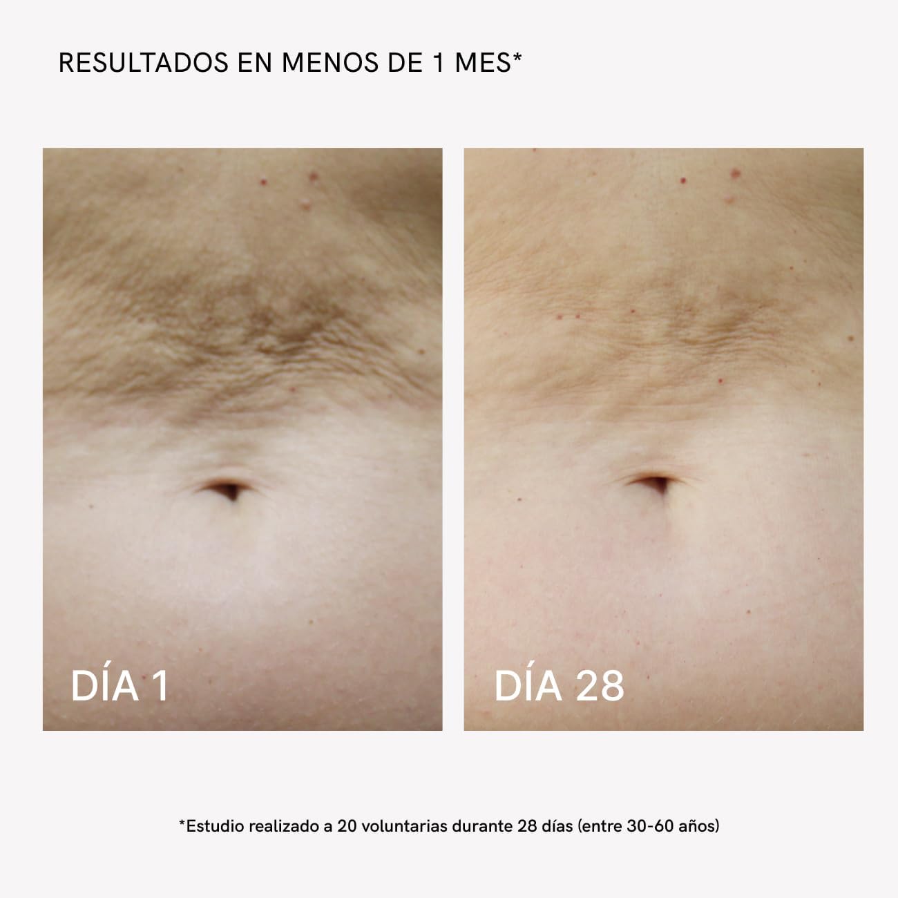 Device application on arm