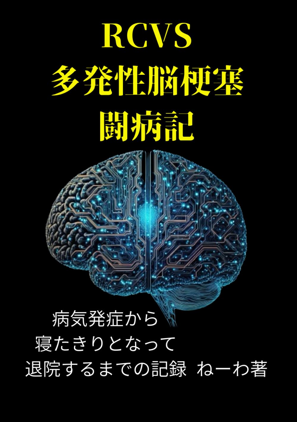 【中古】 脳梗塞は完全に消えた 29歳で4回脳梗塞になりました: 寝たきりのわたしの生き方 | ねーわ