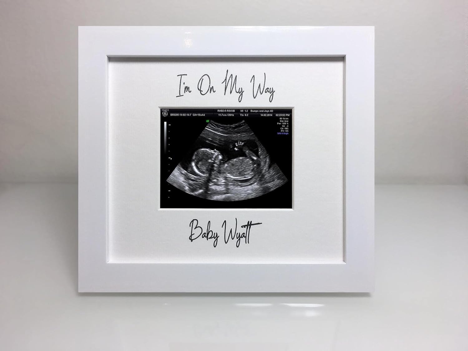 Personalised Ultrasound Baby Scan Free Standing Photo Frame (White)
