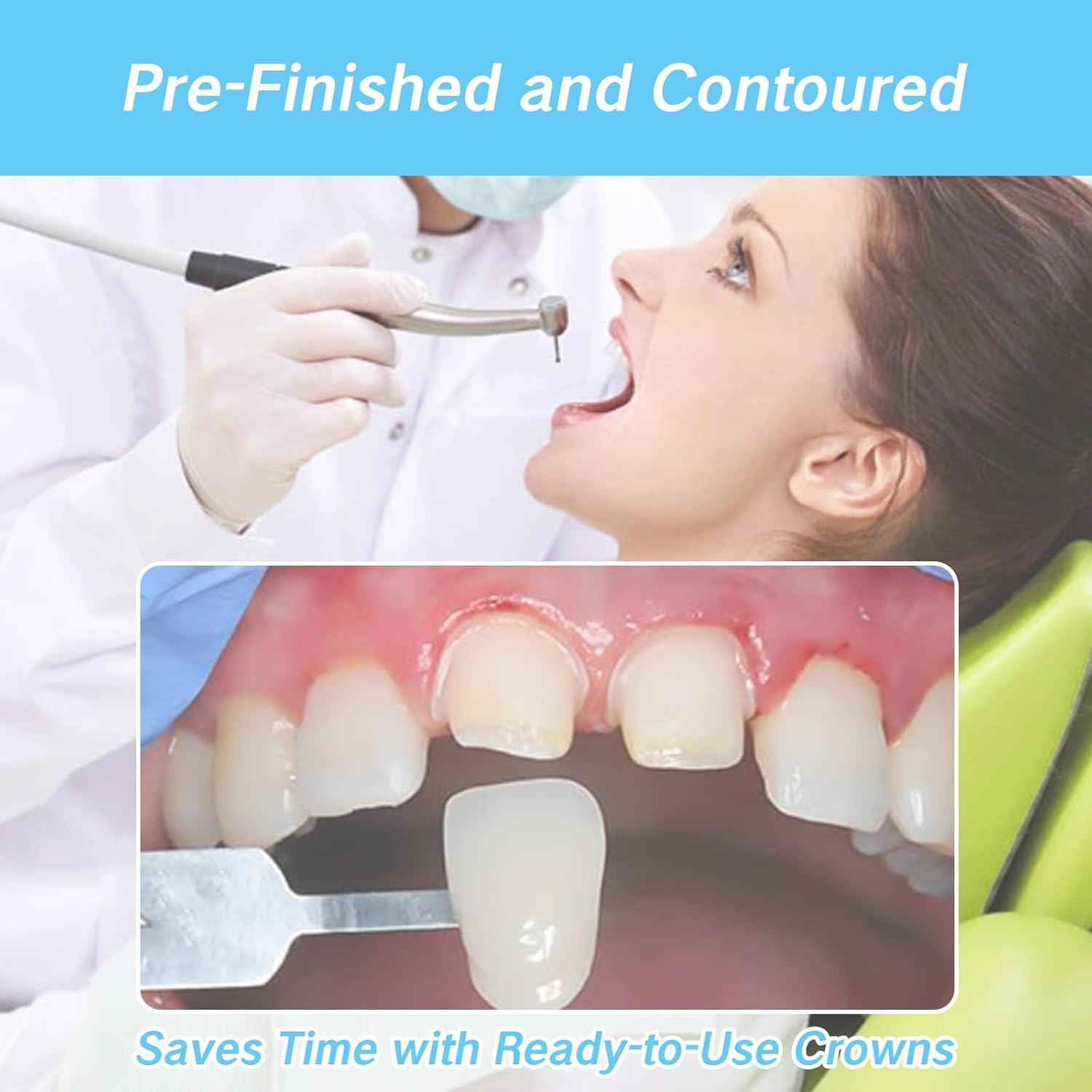 100Pcs Tooth Caps for Broken Tooth Mixed Sizes Dental Crowns Kit Temporary Teeth Covers Front Cap Adults Temporales Crown Repair for Smile Decoration White