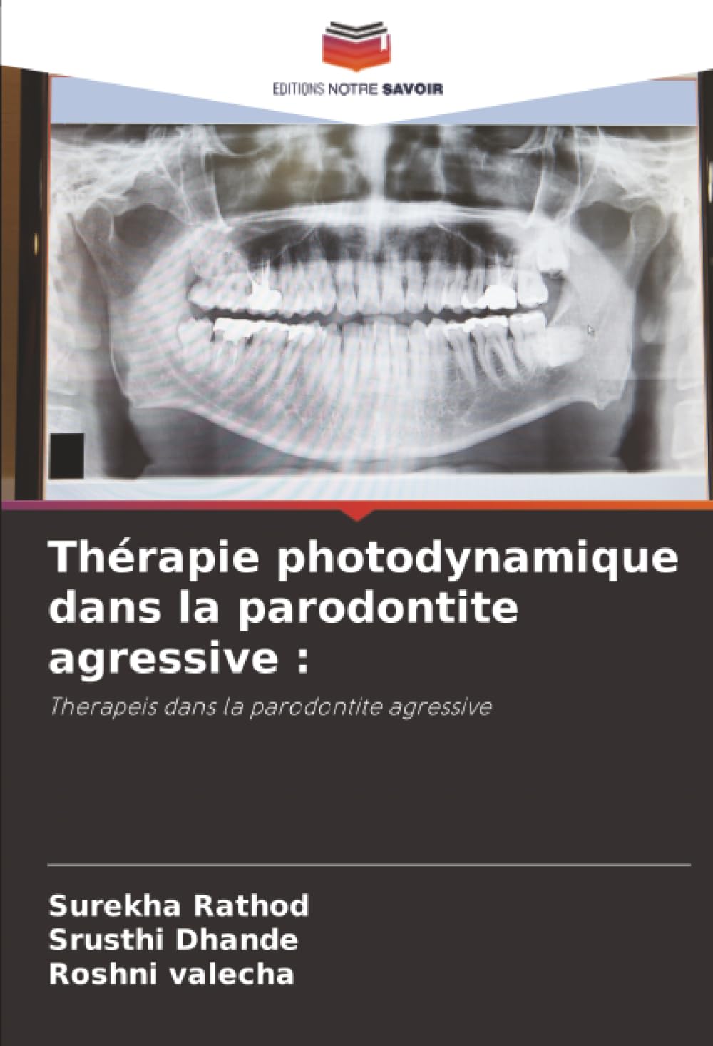 Thérapie photodynamique dans la parodontite agressive :: Therapeis dans la parodontite agressive