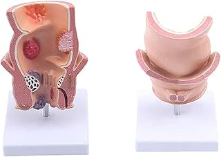 Study Model Rectal Demo Model - Human Organ Anatomy Model Anorectal Model - Medical Teaching Model - Model of Anorectal Teaching Anatomy Model - for Teaching Study (Color : A) SaiFei