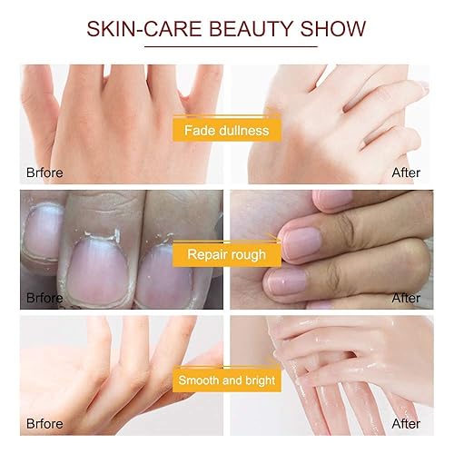 Miniatura 3 de Máscara de mano, 5 pares de guantes hidratantes de manos, máscara de mano reparadora para piel extra seca, máscara exfoliante para pelar las manos,