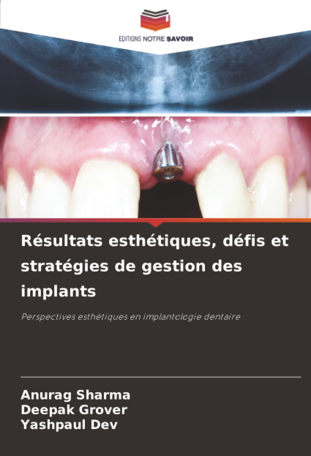 Résultats esthétiques, défis et stratégies de gestion des implants: Perspectives esthétiques en implantologie dentaire