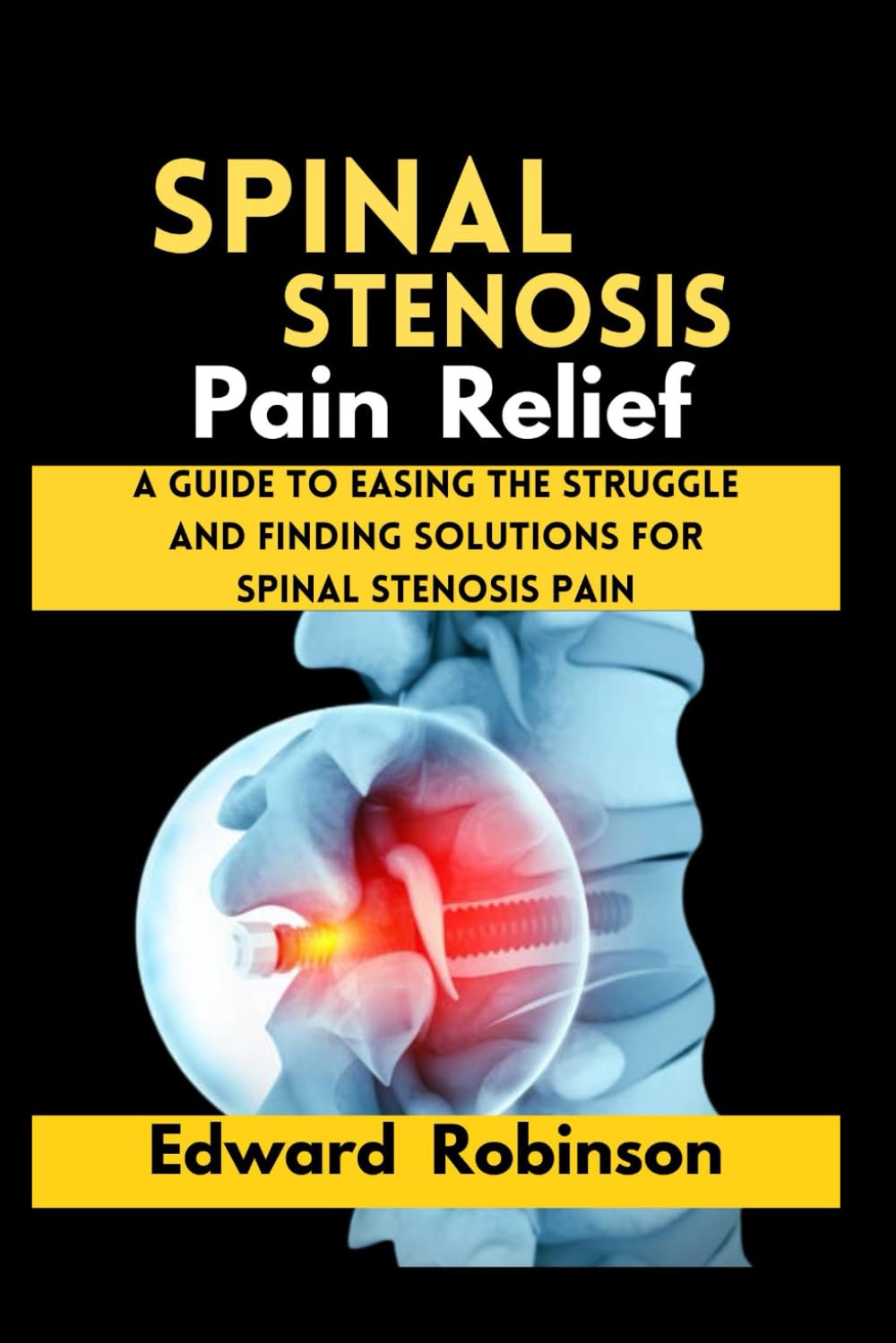 Spinal Stenosis Pain Relief: A guide to Easing the struggle And Finding Solutions For Spinal Stenosis Pain