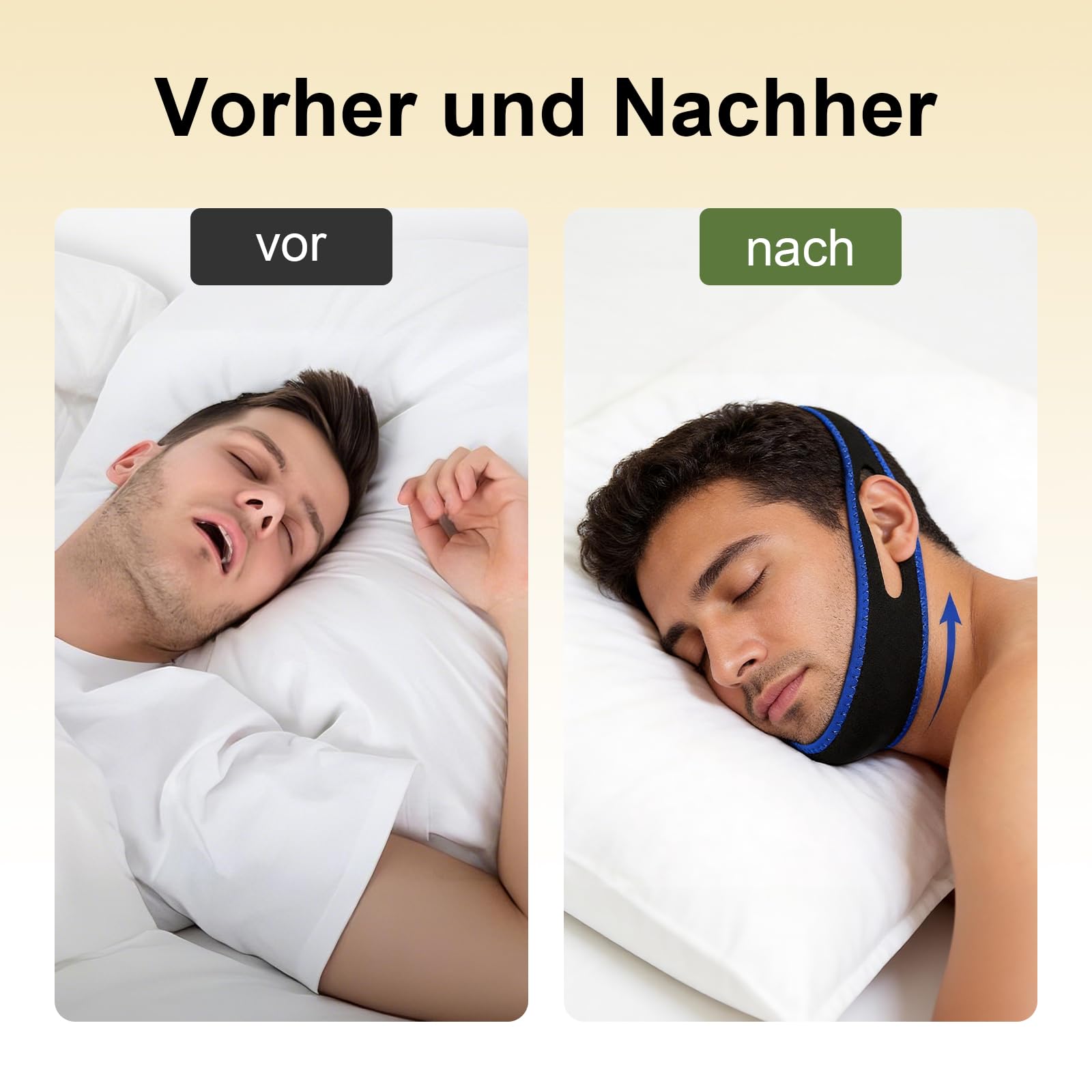2 Stück Anti Schnarchen Kinnriemen,Kinnband Schlafapnoe,Schlafmittel Anti-Schnarchen,Geeignet für Menschen Unterschiedlichen Alters mit 1 Set Schnarchschiene