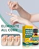 Liquid for Corn removers, Wart Remover 20ML Corn Removers for feet Extra Strength, Fast Acting Foot Corn Remover, Corn Removal for Toes, Corn Pain Remover with 15PCS Cushions 10PCS Swabs
