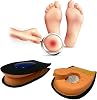 SRTfootcare Heelspur (Epin Topukluk) Hakiki Deri Jel Takviyeli Topuk Dikeni Yarım Tabanlık 1 Çift