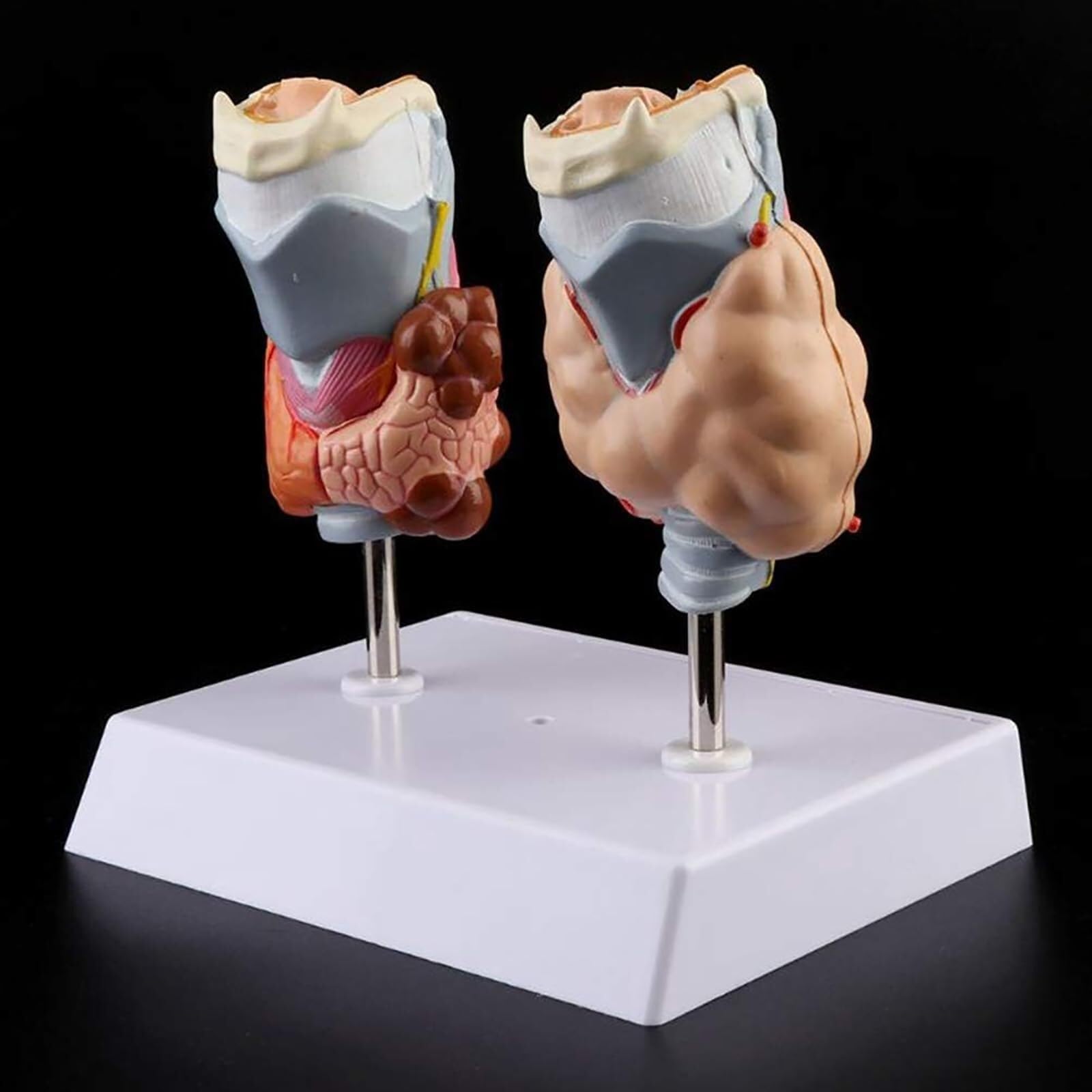 model anatomiczny, Model torbieli guza gardła tarczycy