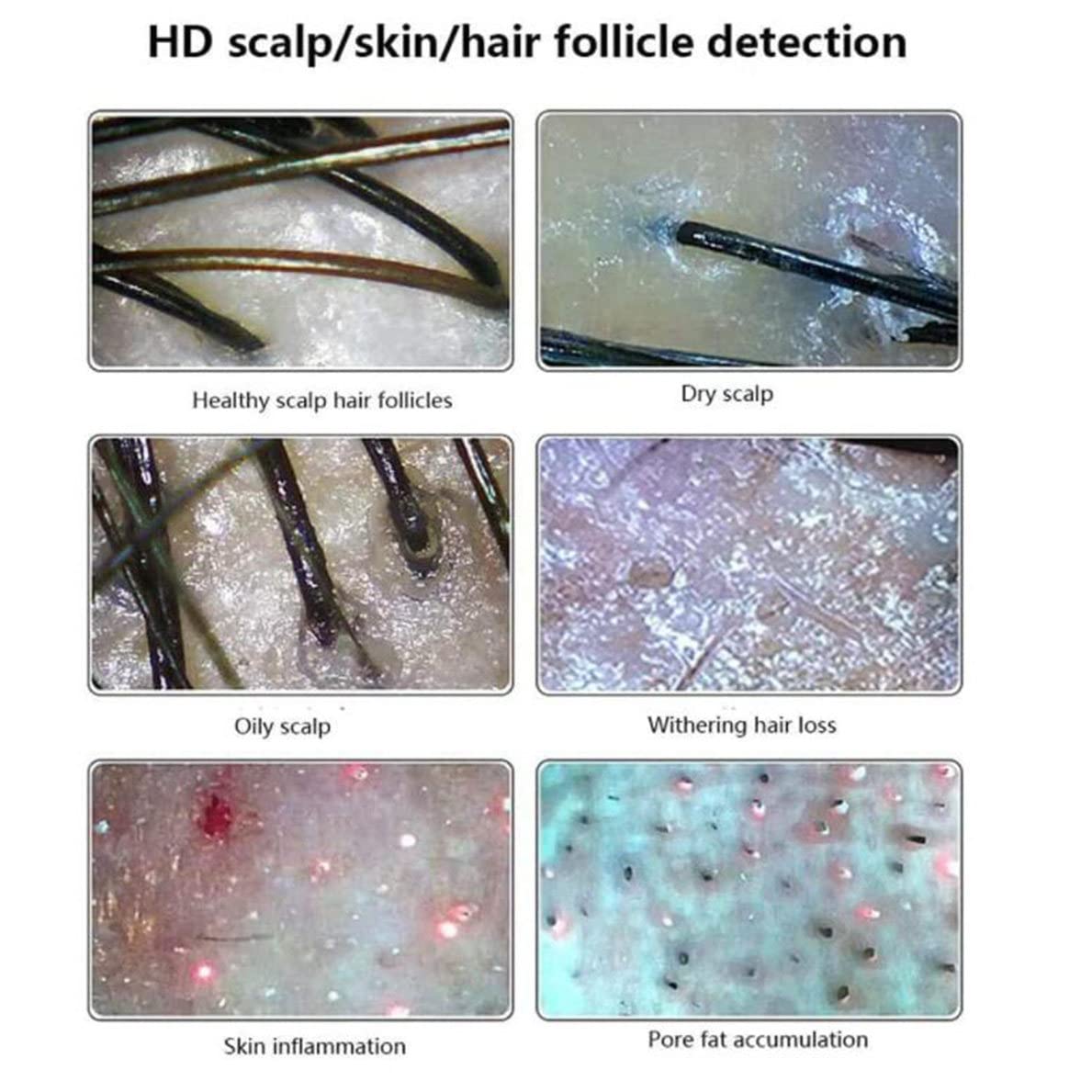 Analizzatore pelle e capelli, schermo 15 pollici, ingrandimento 50x 200x, ABS, fotocamera HD con modalità a tre luci, strumento diagnostico cuoio capelluto e pelle per test follicoli piliferi