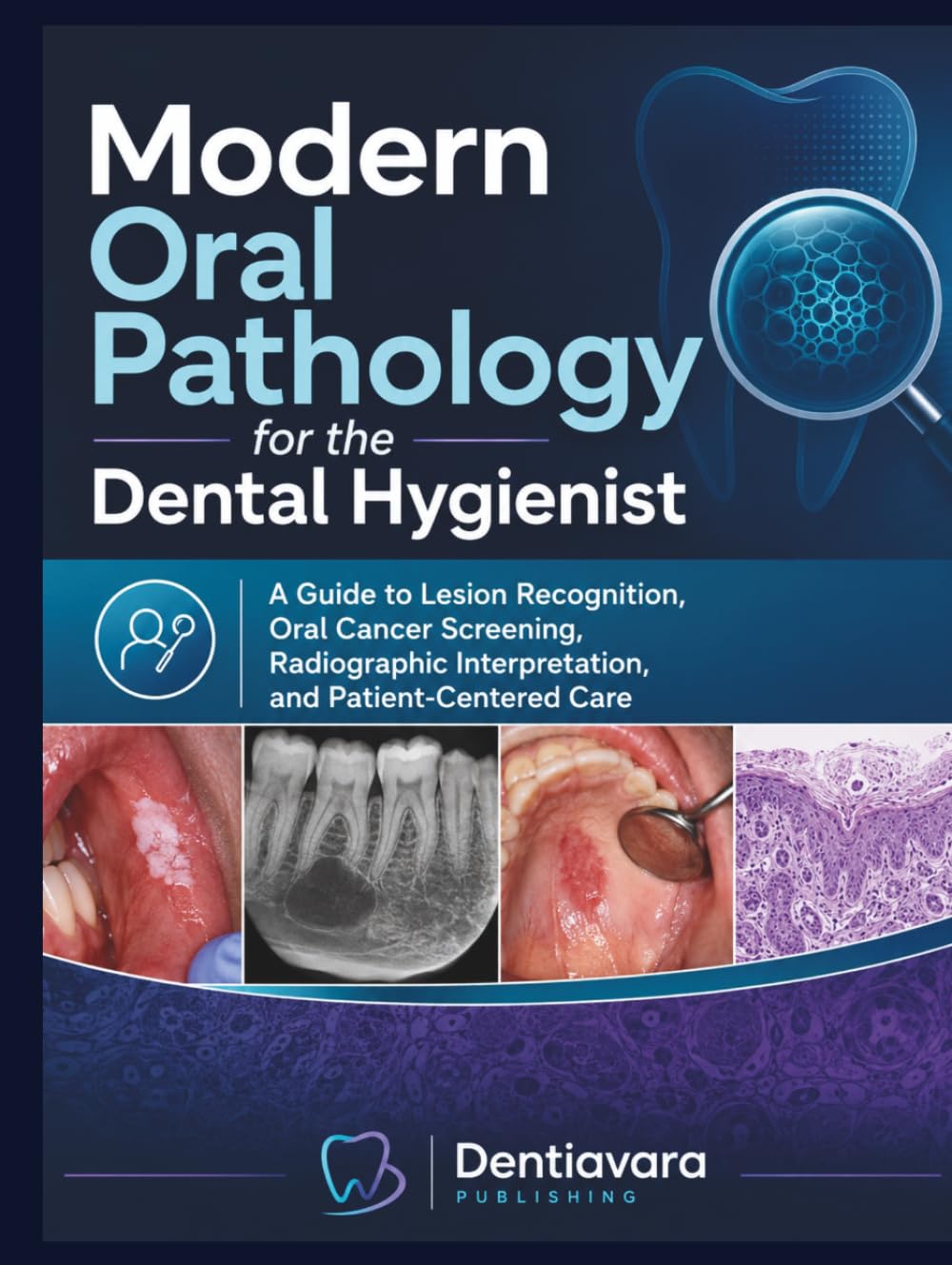Modern Oral Pathology for the Dental Hygienist: A Guide to Lesion Recognition, Oral Cancer Screening, Radiographic Interpretation, and Patient-Centered Care