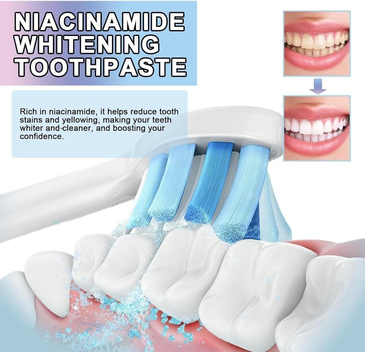 Dentifricio sbiancante alla niacinamide, gel sbiancante alla niacinamide per denti sensibili e alito fresco, dentifricio per rimozione macchie naturale, delicato, ripara e protegge (5 pezzi)