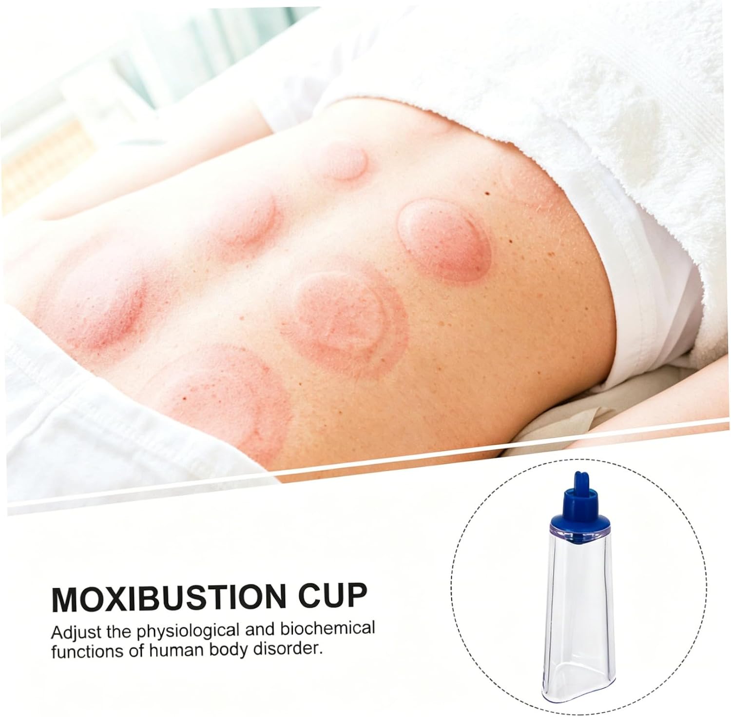 2pcs Cupping Therapy Tool Suction Cups Vacuum Cupping Cups Plastic Moxibustion Pot Traditional Jars