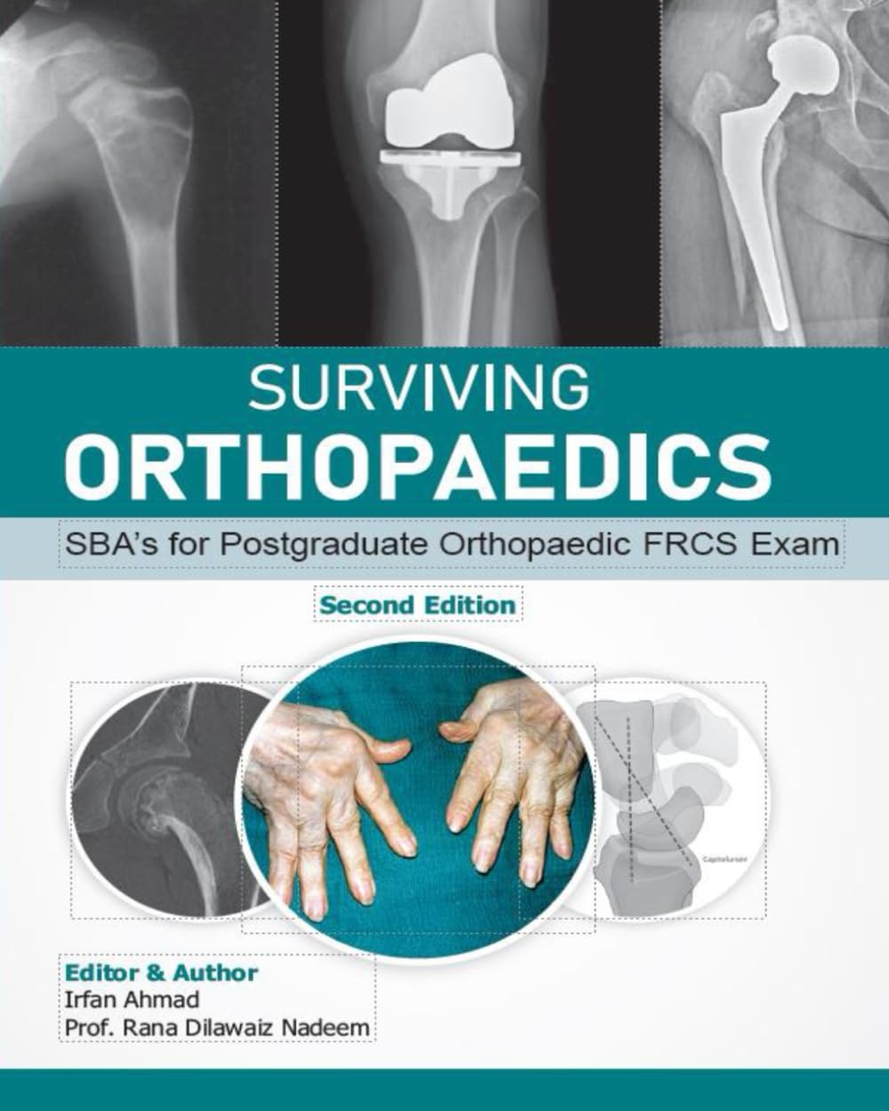 Surviving Orthopaedics: SBA’s for Postgraduate Orthopaedic FRCS and Fellowship Exams (B&W edition)