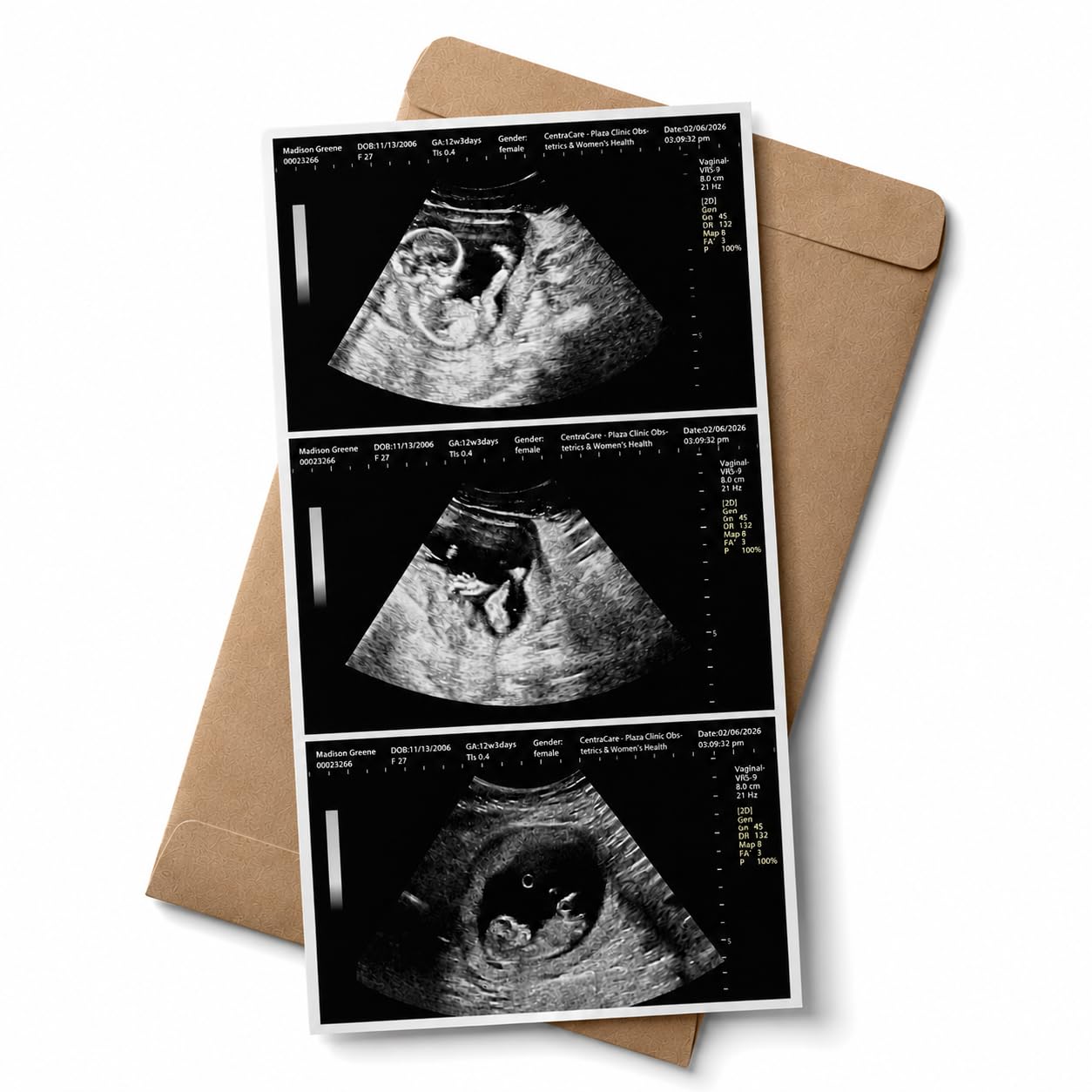 Personalized Fake Ultrasound Prank Photo, Realistic Pregnancy Sonogram Picture for Funny Pregnancy Reveal, Custom Twins Ultrasound Print, Fake Pregnancy Scan Gift 4-30 Weeks
