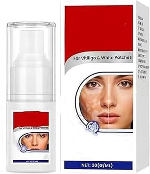 Vitiligo Spray,White Spot Skin Care Spray,Strengthens the Skin Barrier