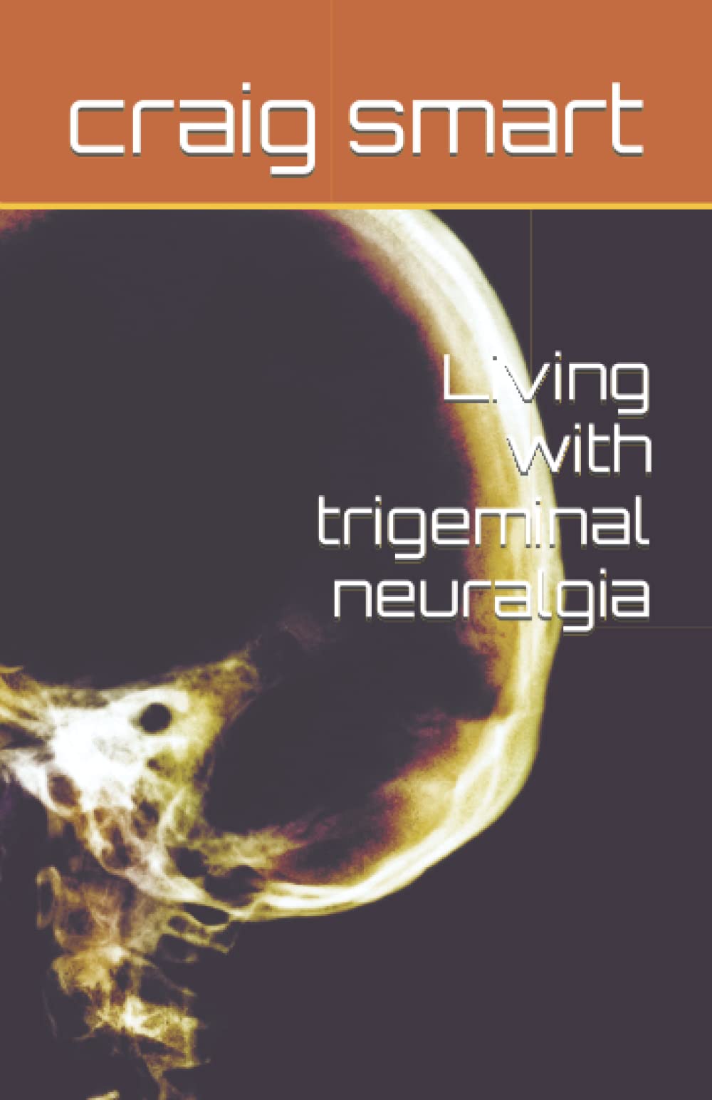 Living with trigeminal neuralgia
