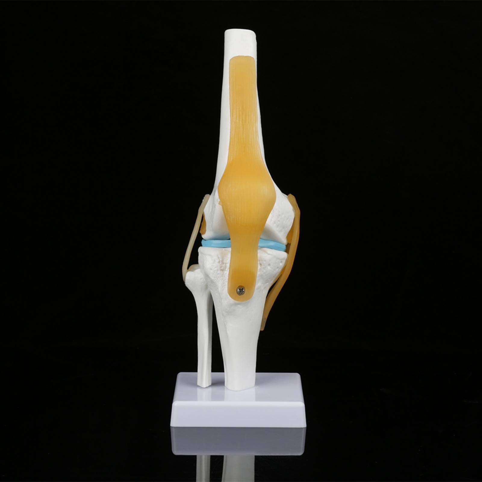 Deluxe Functional Knee Model Life-Size Knee Joint Model With Ligaments ...