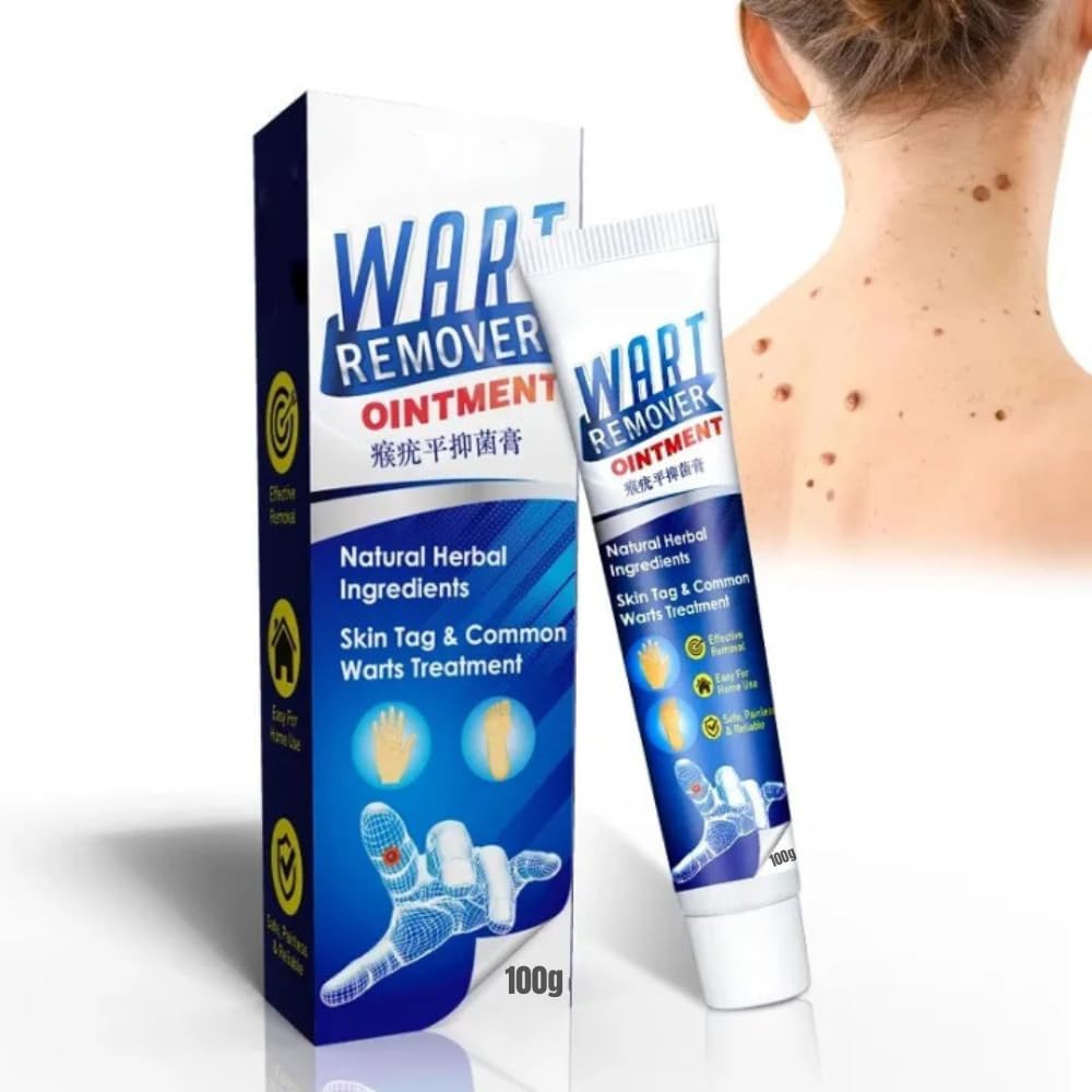 Wart remover cream for wart removal (100gm) | massa remover ointment for skin | skin tag remover cream | Wart remover cream for wart Free Skin for man or women| mole remover cream (Pack of 1) (B0CMQ4LYPZ) Amazon Price History, Amazon Price Tracker