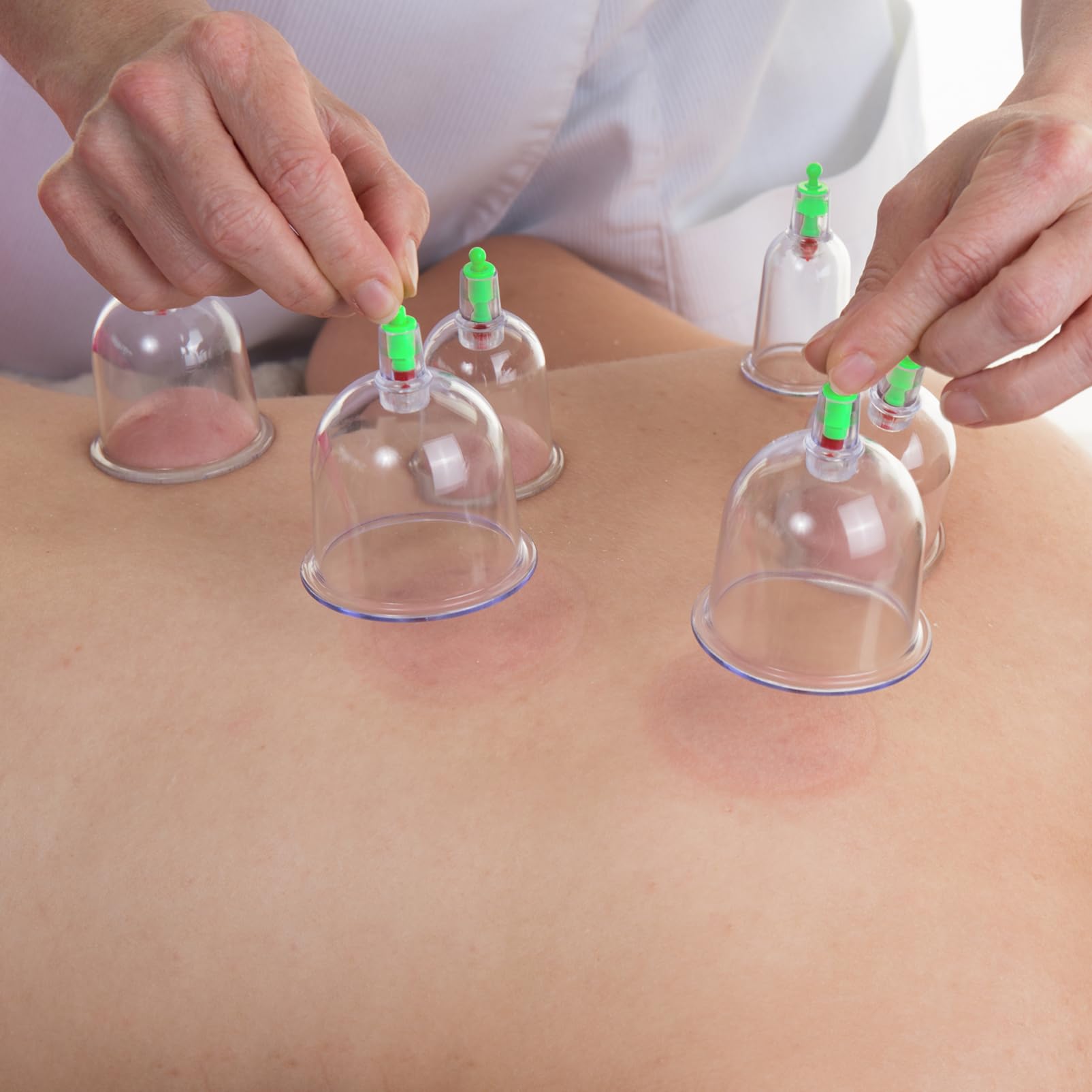 Kit de Ventouses à Vide pour Massage à Domicile, Accessoire de Massage en Plastique, Relaxation Musculaire et Ouverture Douce, 1 Set Fiable