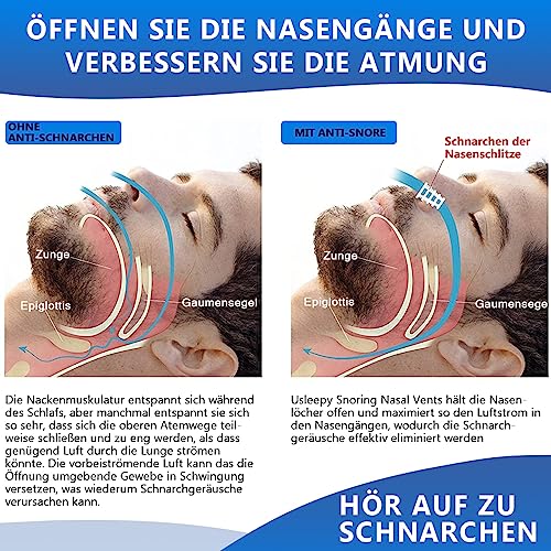 Nasendilatator für Schnarchstopper – Anti-Schnarch-Nasenhilfe