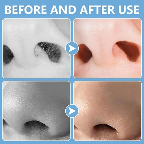 Miniatura 7 de Cortador de pelo nasal 2 en 1, recortador manual de doble cara con cepillo, cuchillo de nariz giratorio de 360 para hombres y mujeres, herramienta