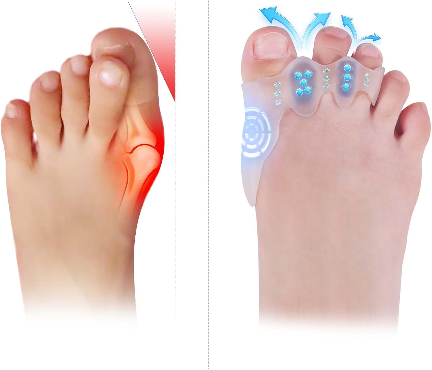 Toe Spacers Bunion Corrector for Kids Toe Bhutan Ubuy