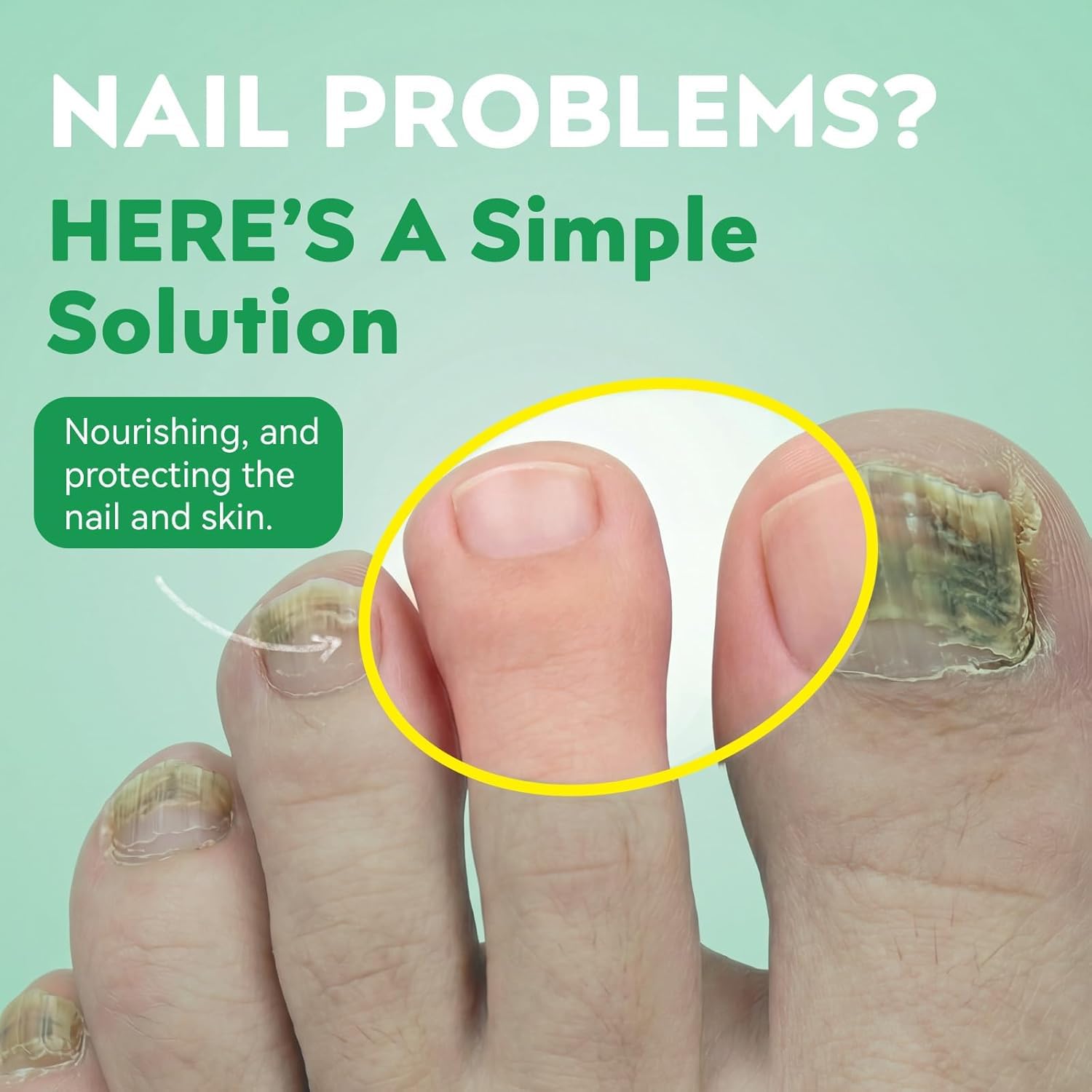 Nagelpilz Stift Original, Schnelle Absorption, präziser Applikator, stärkt und pflegt geschädigte Nägel, geeignet für Hände & Füße (3 stück)