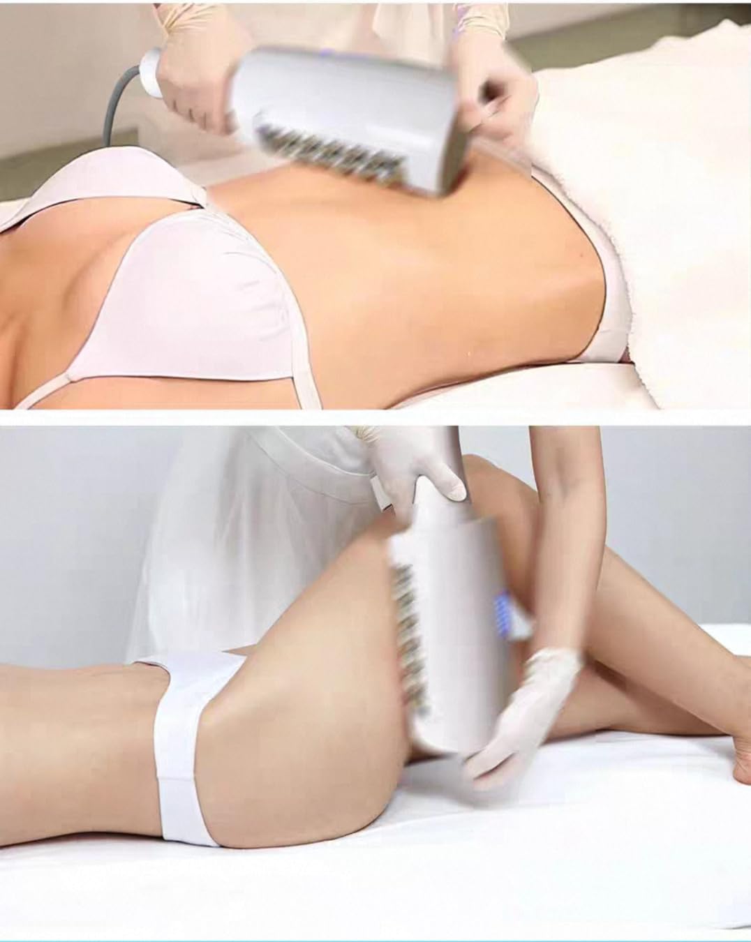 Macchina Sculpting EMS Body Sculpt RF, Roller Massaggio 360°, Riduzione Cellulite, Tonificazione Muscolare