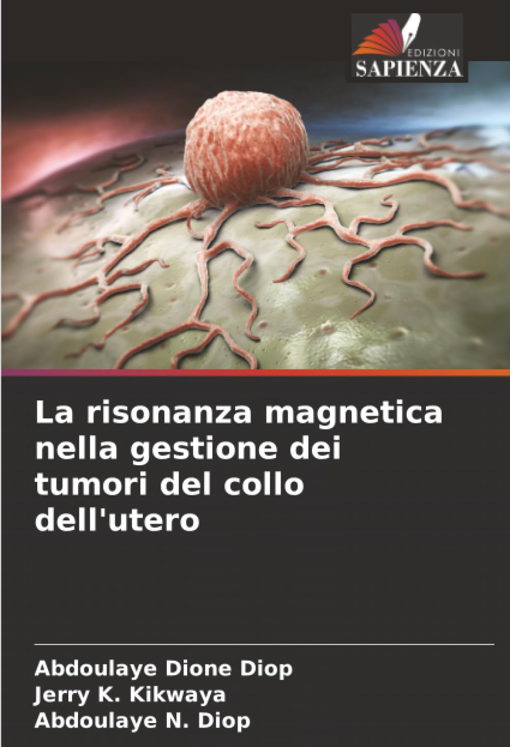 La risonanza magnetica nella gestione dei tumori del collo dell'utero