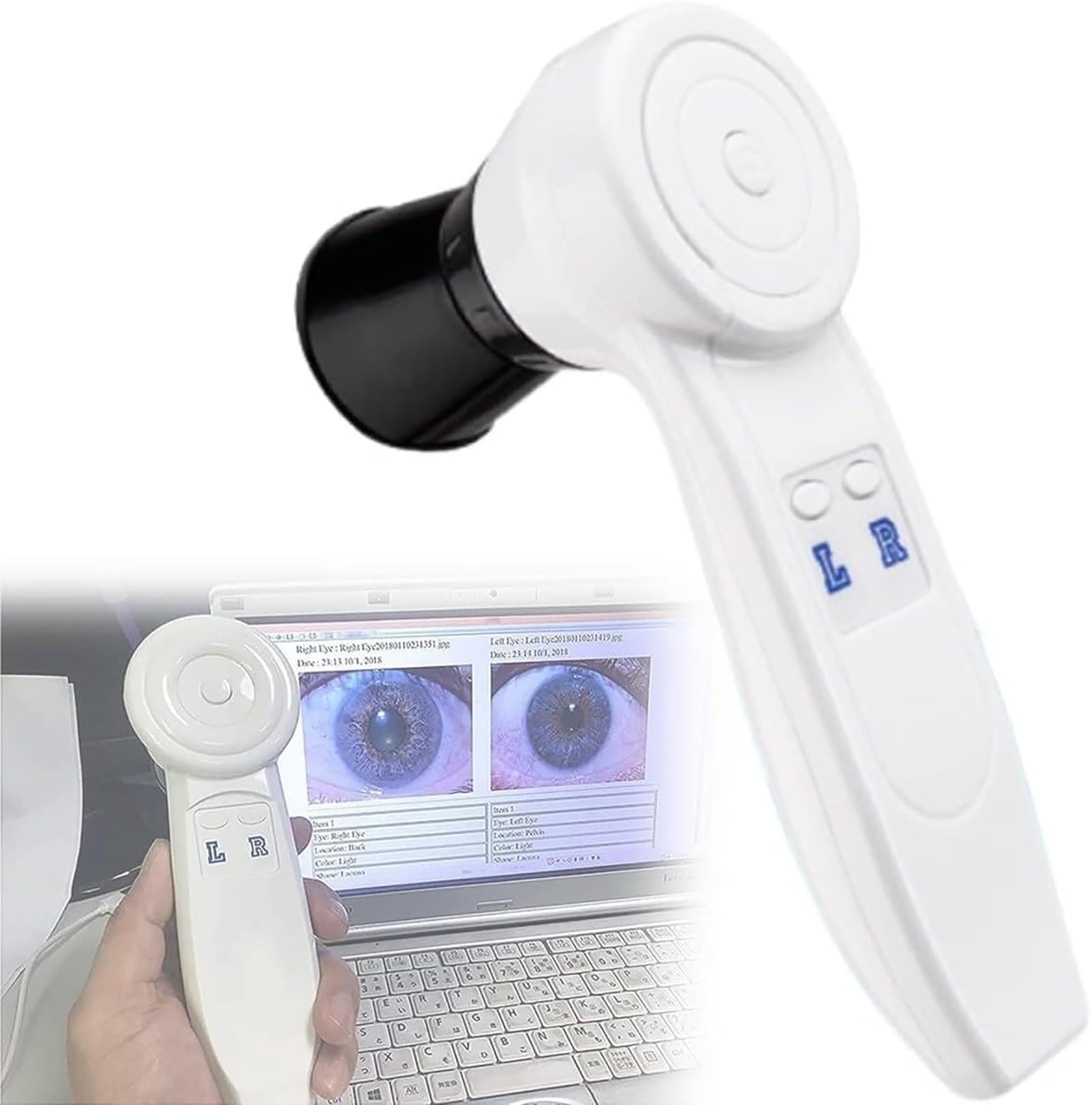 Amazon.co.jp: 自動虹彩検出器虹彩分析カメラ、HD 130万ピクセル虹彩