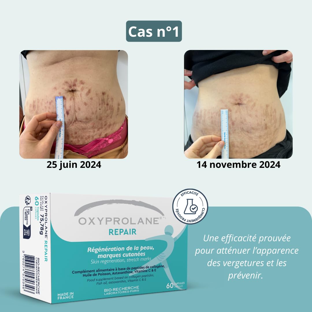 Oxyprolane Repair – Complément Alimentaire Anti-Vergetures | Peau Élastique & Régénérée | Peptides de Collagène, Astaxanthine, Vitamine C & E | 60 Gélules | Beauté & Soin de la Peau