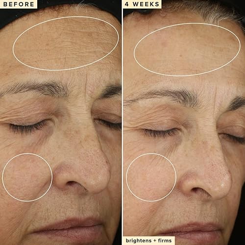 Miniatura 3 de Farmacy Suero facial 10% de vitamina C para la cara, suero facial sin agua con vitamina C y removedor de manchas oscuras para la cara, suero