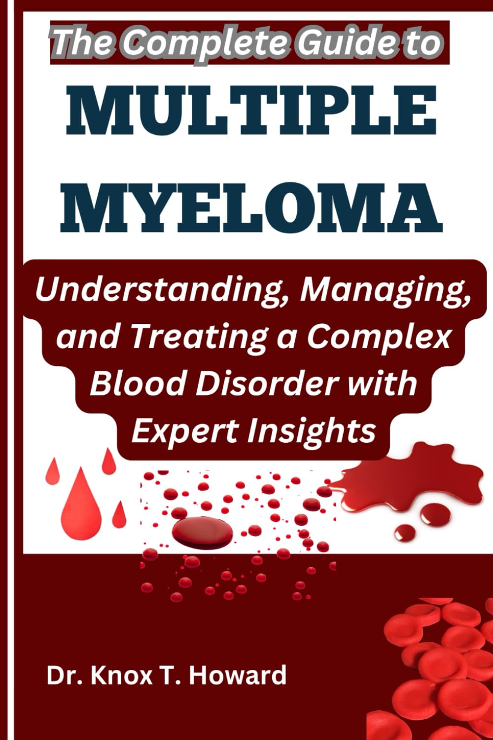 The Complete Guide to Multiple Myeloma: Understanding, Managing, and Treating a Complex Blood Disorder with Expert Insights