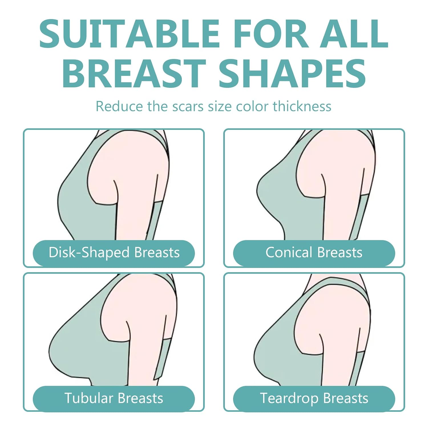 Silicone Scar Sheets Breast - Reusable & Breathable Breast Silicone Scar Tape - Comfortable & Soft Medical Grade Patches for Post-Care Management, 4 Pair