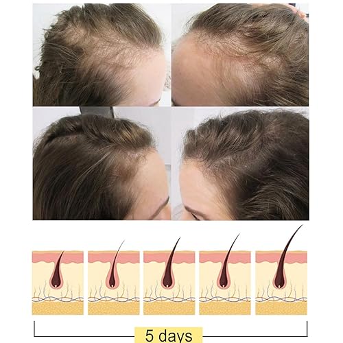 Miniatura 5 de Barra de champú de arroz para el crecimiento del cabello, anti pérdida de cabello, crecimiento del cabello, pH equilibrado, jabón de champú sólido