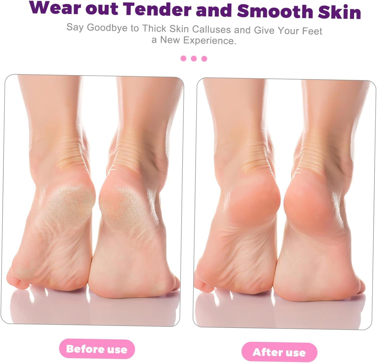 NOLITOY 12pcs Pu Foot Exfoliator Dead Skin Removers Pedicure Tools Callus Shaver for Feet Pumice for Home Use