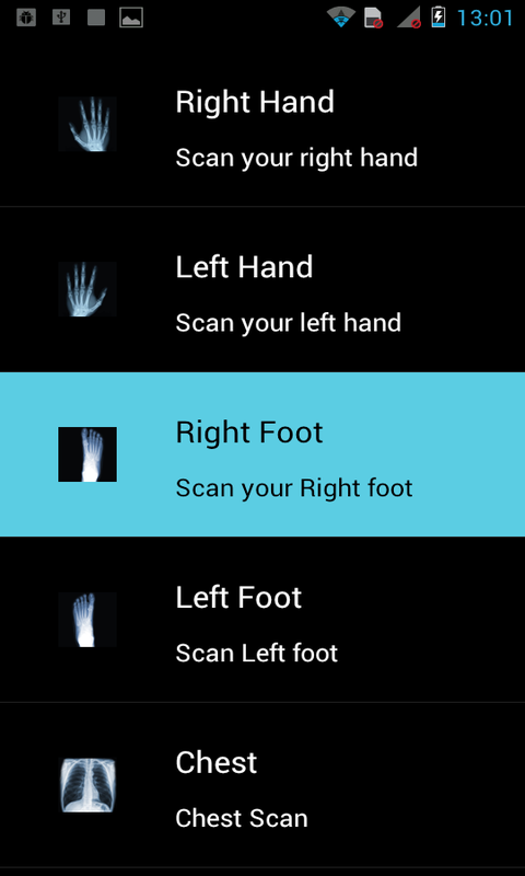 Real X-Ray Scan - App on the Amazon Appstore