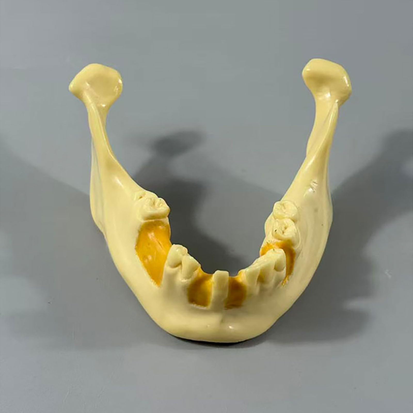 Model szczęki dentystycznej do praktyki implantologicznej, żuchwy do wiercenia i wkładania, idealny do treningu stomatologicznego i praktyki implantów zębów, do skutecznej praktyki