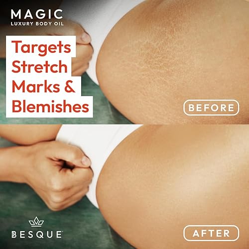 Miniatura 6 de Besque Aceite corporal mágico, 3.38 onzas líquidas, aceite corporal para después de la ducha para mujeres, cuidado de la piel hidratante para todo