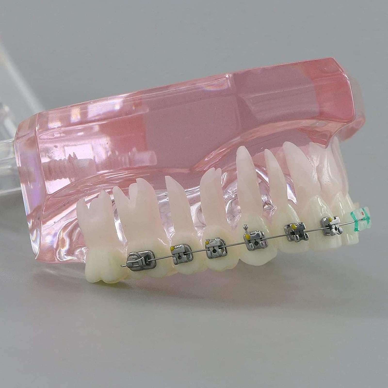 Zahnärztliches kieferorthopädisches Demonstrationsmodell,kieferorthopädisches Retainer-Behandlungsmodell für Zahnzähne mit selbstligierenden Metallklammern,die das Modell erklären