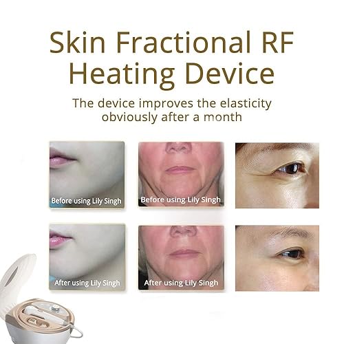 Miniatura 6 de Elitzia Alta máquina facial, dispositivo portátil de ajuste facial del uso en el hogar para el antienvejecimiento profesional