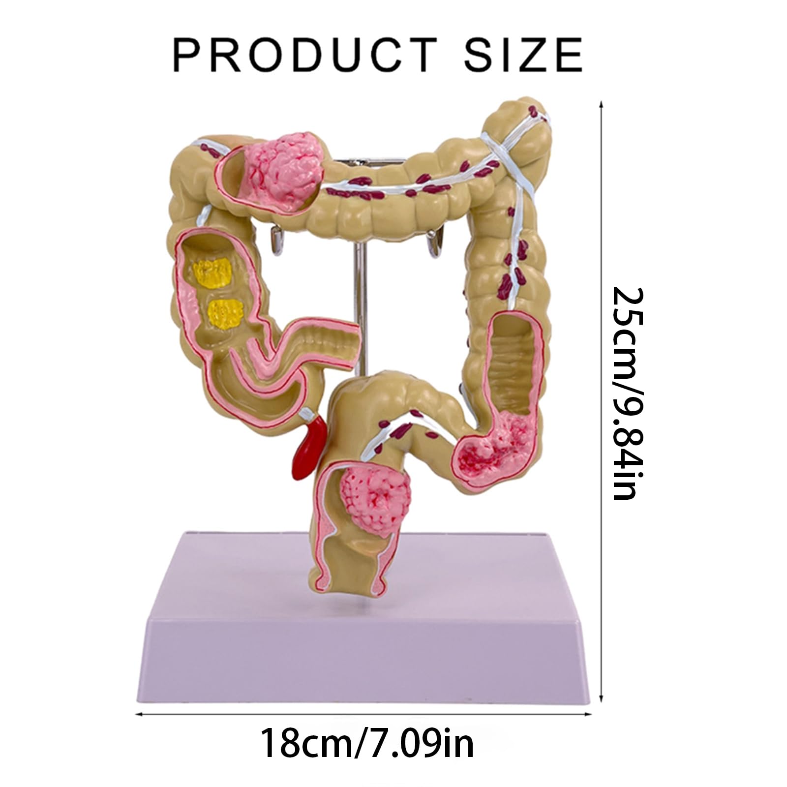 Modello umano dell'intestino crasso Patologie umane del modello dell'intestino crasso Strumento didattico per studi scolastici di laboratorio Patologie del modello dell'intestino crasso Modello di