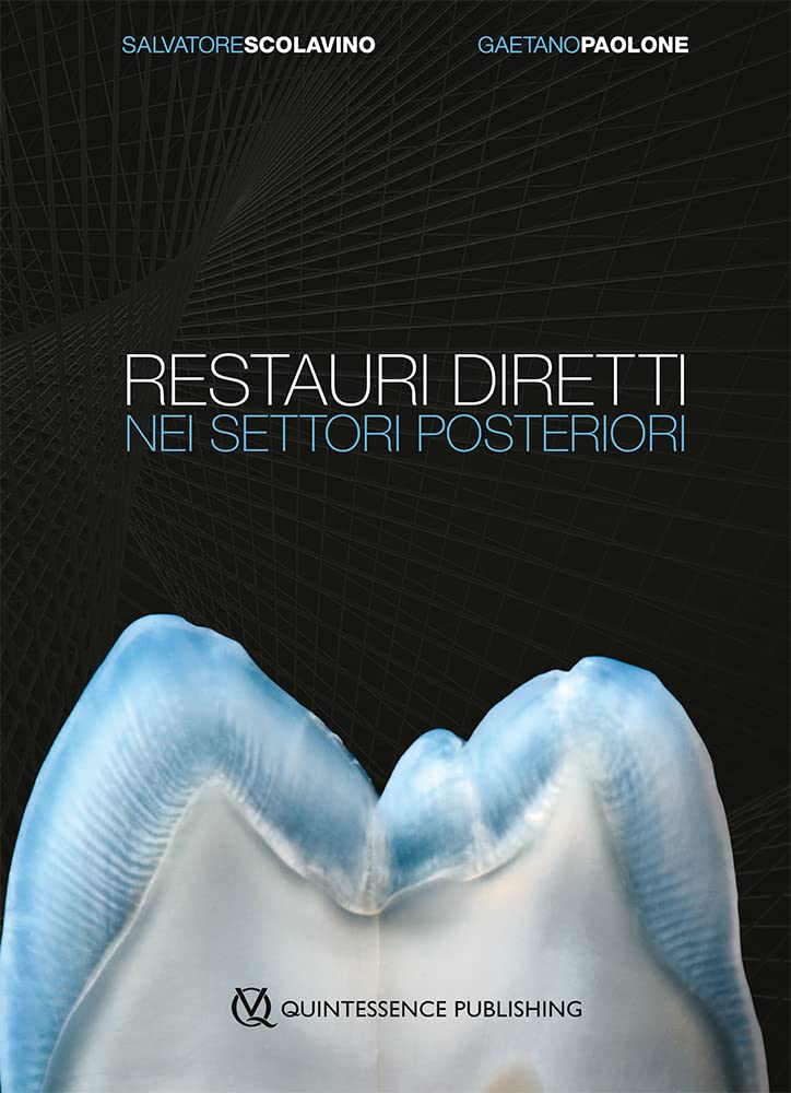 Restauri diretti nei settori posteriori
