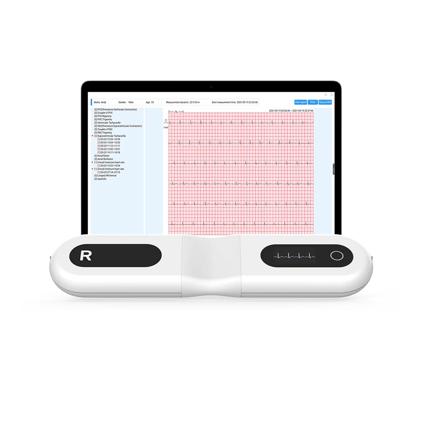 Wellue 24 ore dispositivo ECG per la casa, analisi AI, ECG Event Recorder, compatibile con Ios e Android, Mac e Windows, tempo di monitoraggio da 5 minuti a 24 ore