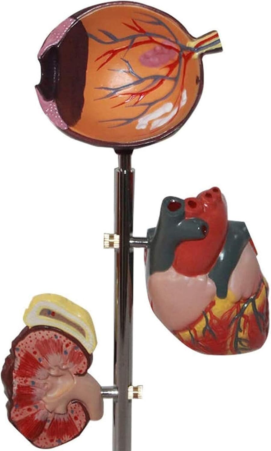 Modèle d'organe du diabète - Modèle d'anatomie médicale Modèle de diabète - Modèle Scientifique d'anatomie Humaine Amovible - for l'éducation et la Formation médicales