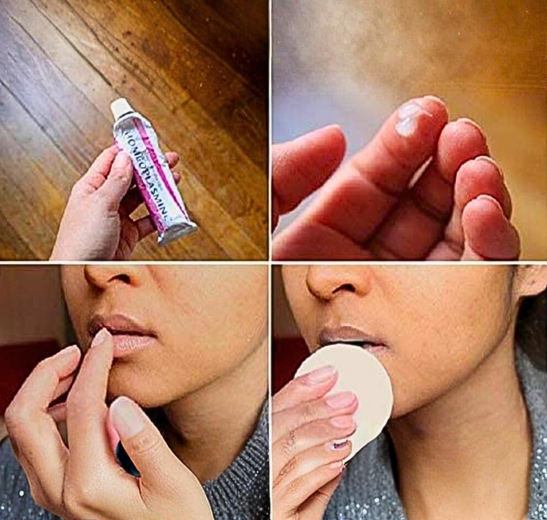 Homeoplasmine, XL - 40g Magic Cream - For Dry Skin, Irritations, for Soft Lips! [ The Original French Packaging ]