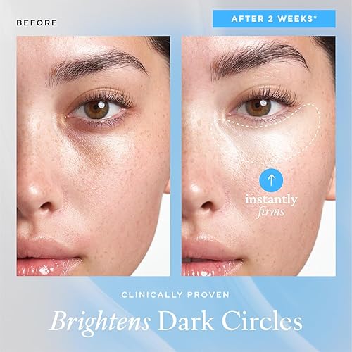 Miniatura 8 de belif Aqua Bomb Gel refrescante para ojos, cafeína y ácido hialurónico para hinchazón e hidratación, niacinamida y vitamina C para ojeras, adenosina