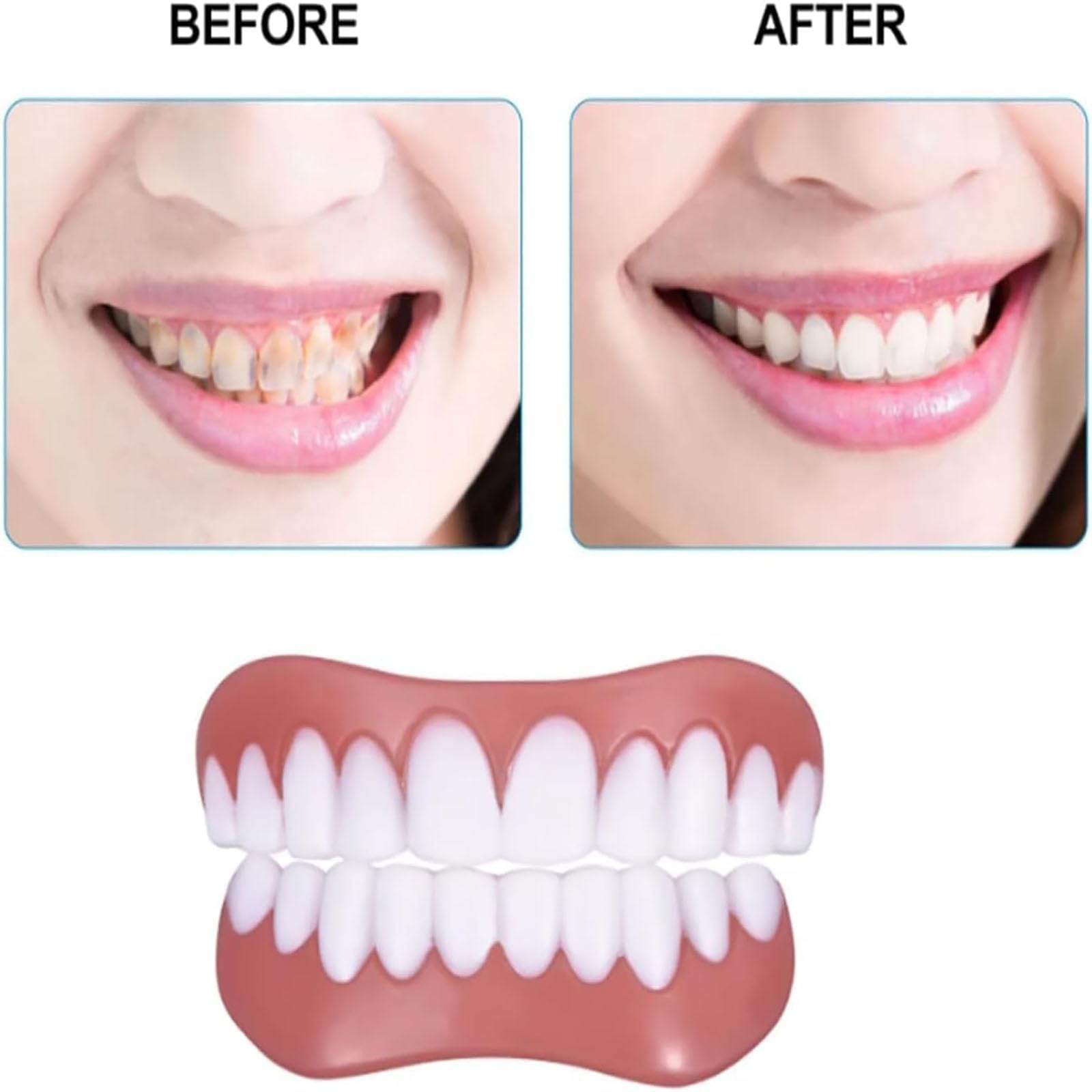 Biancat Greatfit Kit de 5 cordes dentaires en silicone Yunpso - Kit de tendage dentaire en silicone naturel et confortable - Veneers inférieurs et doux - Pour rendre votre sourire plus confiant