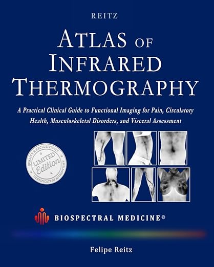 ATLAS OF INFRARED THERMOGRAPHY: A Practical Clinical Guide: Functional Imaging for Pain, Circulatory Health, Musculoskeletal Disorders, and Visceral Assessment